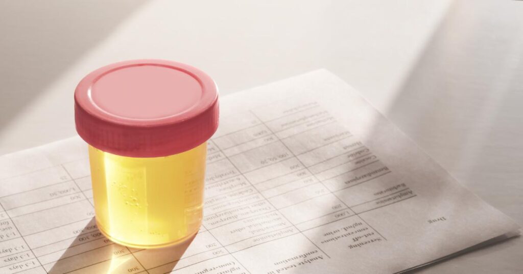 urine sample in a labeled collection cup resting on a drug test results form
